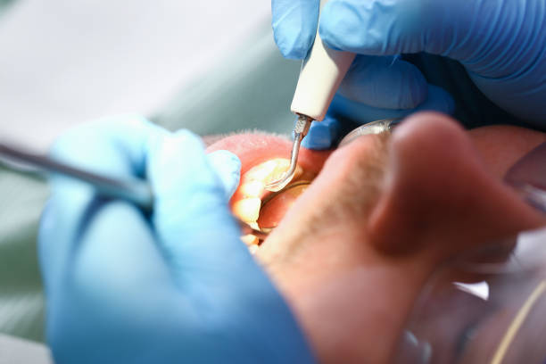 Best Emergency Dental Services for Seniors in Stoneville, NC