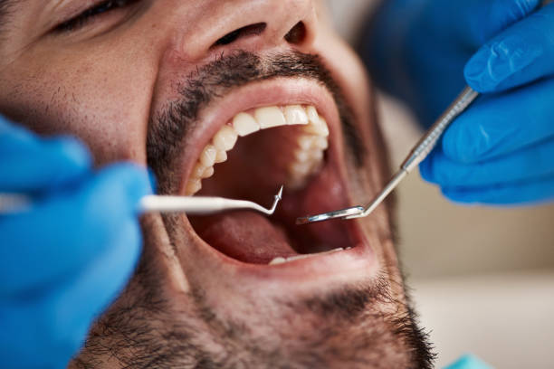 Best Weekend Emergency Dentist in Stoneville, NC
